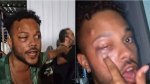 Publicitário denuncia agressão e racismo no Festival de Verão; veja