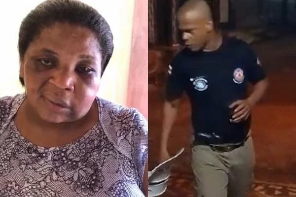 Vídeo: mulher agredida por PM mostra situação do rosto após tapa