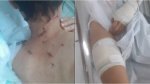 Motorista de aplicativo leva mais de 20 facadas em assalto na RMS