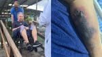 Turista morre após picada de aranha em Morro de São Paulo