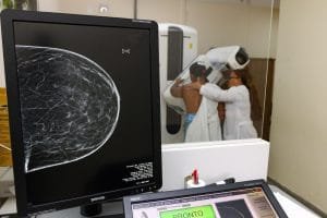 mamografia 300x200