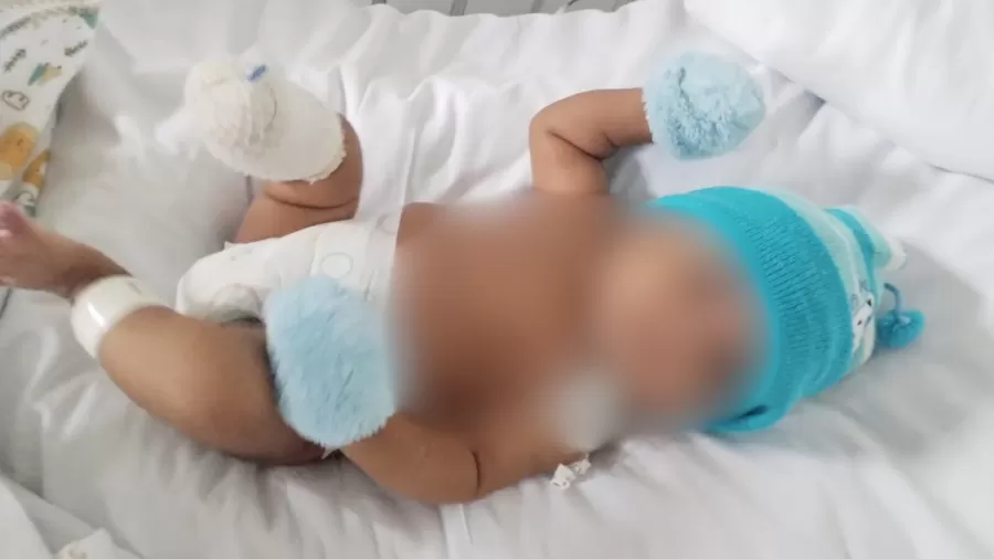 heitor teve o pe amputado apos falha de acesso intravenoso 1751568984934 v2 900x506.png