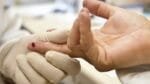 Casos de HIV crescem 17% entre jovens na Bahia