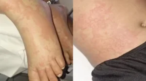Criança é internada após contato com detergente da Ypê