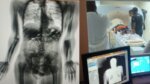 BodyScan identifica drogas no corpo de presos que voltavam ao presídio