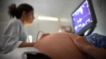 Gestantes podem iniciar pré-natal gratuito sem agendamento em Salvador